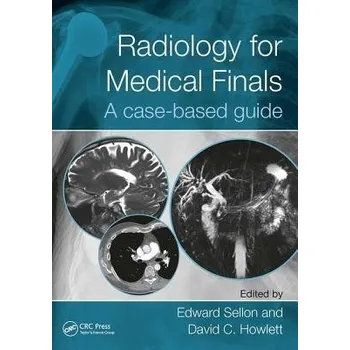 Cizojazyčná kniha Radiology for Medical Finals