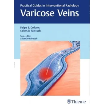 Varicose Veins - Felipe B. Collares, Salomão Faintuch [EN] (2017, pevná)