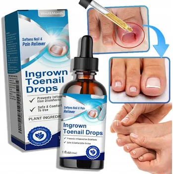 Kosmetika na nohy Léčba plísně nehtů na nohou - Léčba plísně nehtů na nohou - Léčba plísně nehtů na nohou - Léčba plísně nehtů na nohou