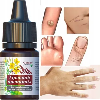 Vrták Vlaštovičník horský extrakt - Silný přípravek na bradavice a kuří oka 20ml