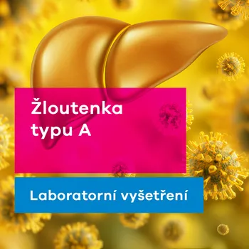 Diagnostický test EUC Laboratoře Žloutenka typu A