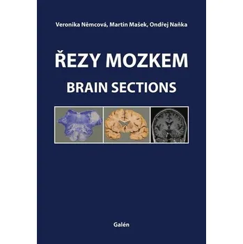 Řezy mozkem / Brain Sections - Veronika Němcová