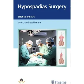 Hypospadias Surgery - Chandrasekharam, Vvs