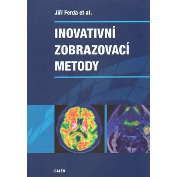 Učebnice Inovativní zobrazovací metody - kol.