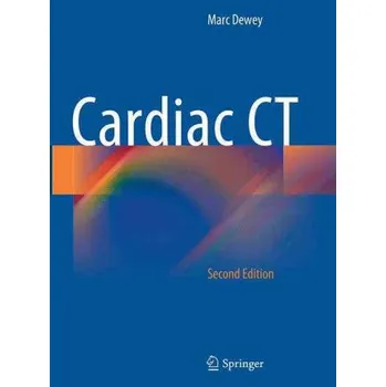 Cizojazyčná kniha Cardiac CT (Marc Dewey)(Brožovaná)