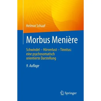 Morbus Menière - Schaaf, Helmut [DE] (2022, Měkká, Springer-Verlag GmbH)