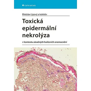 Kniha Toxická epidermální nekrolýza Ekniha