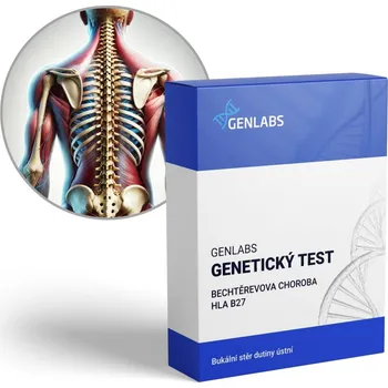 Diagnostický test GENLABS 1x Bechtěrevova choroba (HLA B27)