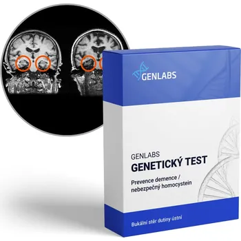 Diagnostický test GENLABS 1x Prevence demence, nebezpečný homocystein (COMT, MTHFR, MTRR, MTR a ApoE)