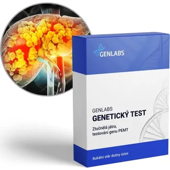 Diagnostický test GENLABS 1x Ztučnělá játra (PEMT)