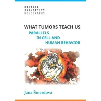 Příroda What tumors teach us - Parallels in cell and human behavior - Jana Šmardová