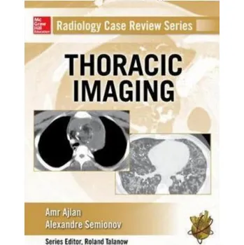 Kniha Radiology Case Review Series: Thoracic Imaging (Amr M Ajlan,Alexander Semionov)(Brožovaná)