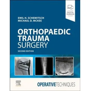 Operative Techniques: Orthopaedic Trauma Surgery (EMIL SCHEMITSCH)(Pevná)