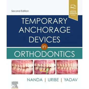 Temporary Anchorage Devices in Orthodontics (Ravindra Nanda,Flavio Andres Uribe,Sumit Yadav)(Pevná)