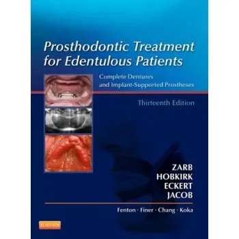 Prosthodontic Treatment for Edentulous Patients (George A Zarb)(Pevná)