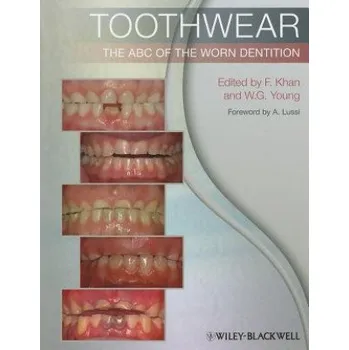 Učebnice Toothwear - The ABC of the Worn Dentition (Farid Khan)(Brožovaná)