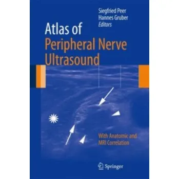 Cizojazyčná kniha Atlas of Peripheral Nerve Ultrasound (Peer)(Pevná)