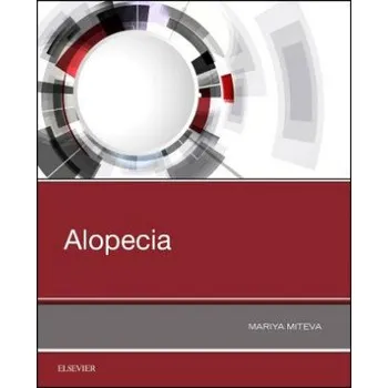 Alopecia (Mariya I Miteva)(Brožovaná)