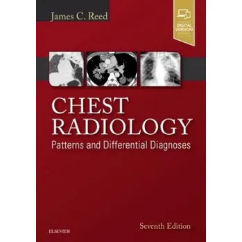 Chest Radiology (James C. Reed)(Pevná)