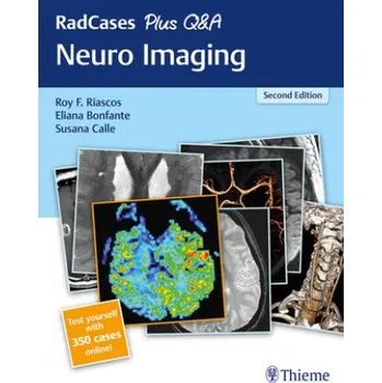 RadCases Plus Q&A Neuro Imaging (Roy Riascos,Eliana Bonfante,Susana Calle)(Brožovaná)