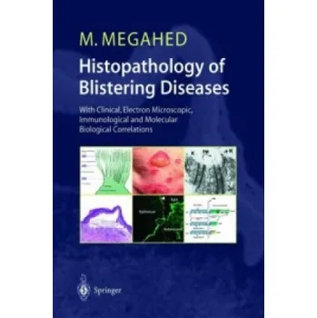 Cizojazyčná kniha Histopathology of Blistering Diseases (Mosaad Megahed)(Brožovaná)