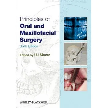 Učebnice Principles of Oral and Maxillofacial Surgery 6e (U. J. Moore)(Brožovaná)