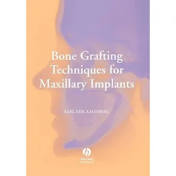 Bone Grafting Techniques for Maxillary Implants (Karl-Erik Kahnberg)(Pevná)