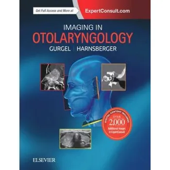 Imaging in Otolaryngology (Richard K. Gurgel,H. Ric Harnsberger)(Pevná)