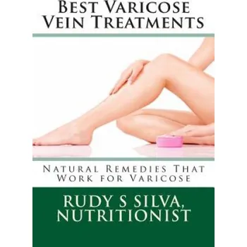 Cizojazyčná kniha Best Varicose Vein Treatments: Natural Remedies That Work for Varicose (Rudy Silva Silva)(Brožovaná)
