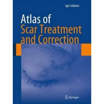 Cizojazyčná kniha Atlas of Scar Treatment and Correction (Safonov)(Pevná)