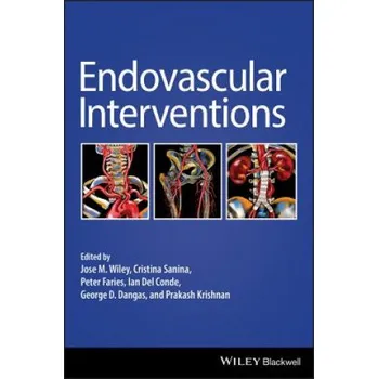 Endovascular Interventions (JOSE WILEY)(Pevná)