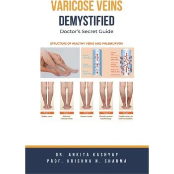 Varicose Veins Demystified (Krishna N. Sharma)(Brožovaná)
