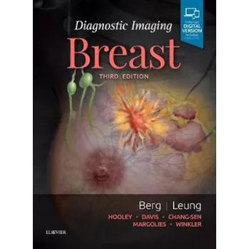 Diagnostic Imaging: Breast (WENDIE A. BERG)(Pevná)