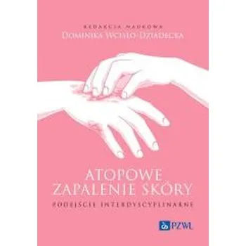 Atopowe zapalenie skóry. Podejście interdyscyplina - Wcisło-Dziadecka Dominika