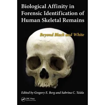 Biological Affinity in Forensic Identification of Human Skeletal Remains – Gregory E. Berg,Sabrina C. Ta'ala (EN)