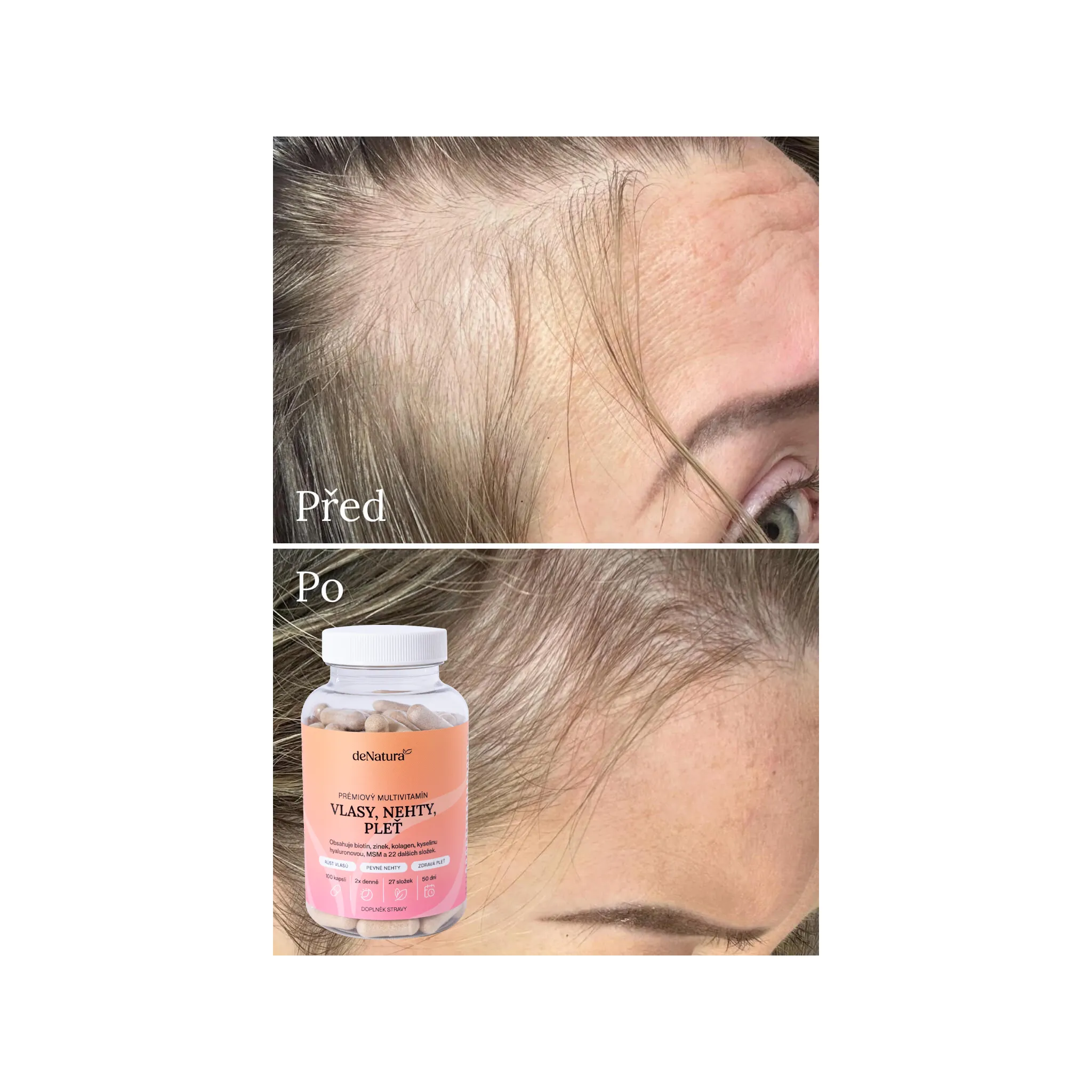 Fotografie 8 - Sérum na obočí a řasy deNatura Sérum na řasy 3 ml + Prémiový vitamínový komplex 100 cps.
