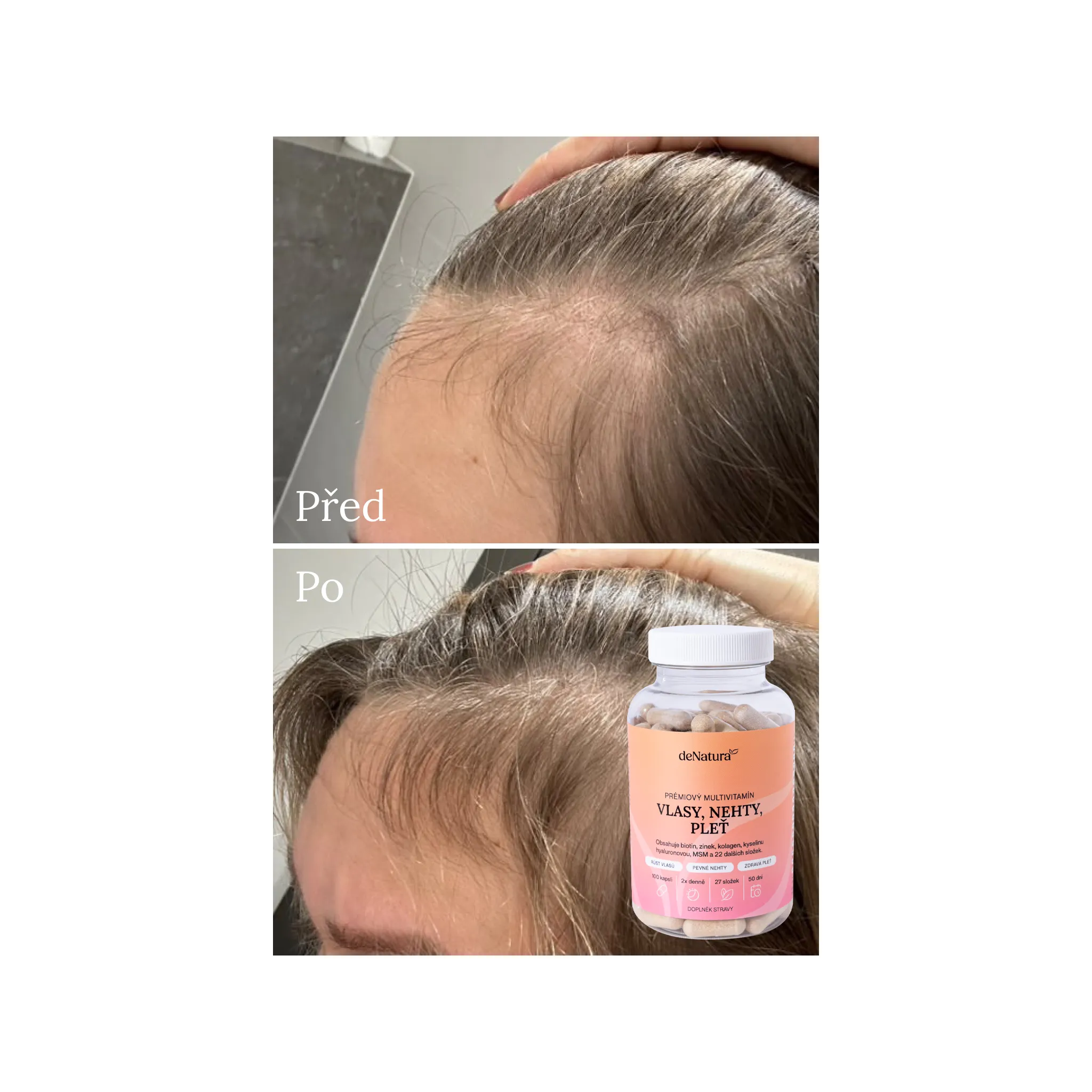 Fotografie 7 - Sérum na obočí a řasy deNatura Sérum na řasy 3 ml + Prémiový vitamínový komplex 100 cps.