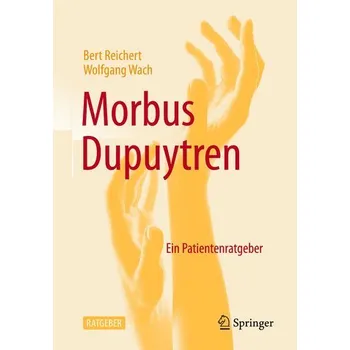 Ratgeber Morbus Dupuytren - Wach, Wolfgang