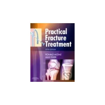 Practical Fracture Treatment - Churchill Livingstone Churchill Livingstone