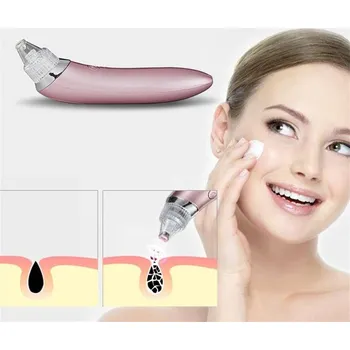 Elektrický čistič pleti Vakuový čistič pleti na akné a černé tečky