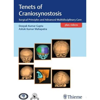 Tenets of Craniosynostosis - Gupta, Deepak Kumar