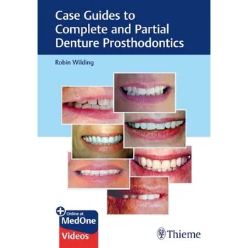 Case Guides to Complete and Partial Denture Prosthodontics - Wilding, Robin