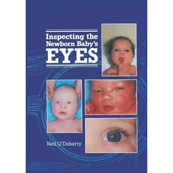 Inspecting the Newborn Baby's Eyes - M. Doherty