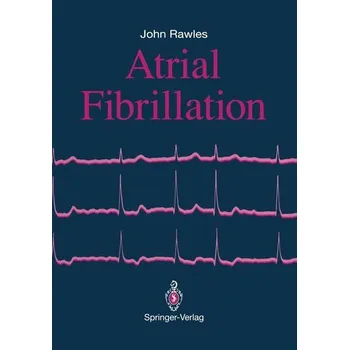 Atrial Fibrillation - Lunderstädt, Reinhart