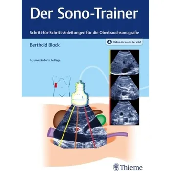 Der Sono-Trainer - Berthold Block [DE] (2021, Mix, Thieme, Stuttgart)