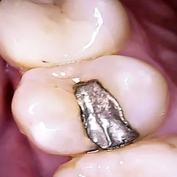 WIFI HD Dentální kamera Z70