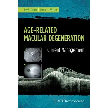 Cizojazyčná kniha Age-Related Macular Degeneration - Duker, Jay a Witkin, Andre