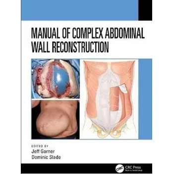 Kniha Manual of Complex Abdominal Wall Reconstruction