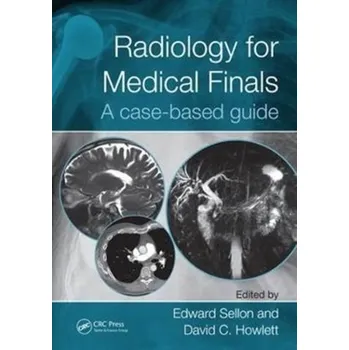 Radiology for Medical Finals