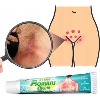 Krém na lupénku, mast na ekzém, lupénka pokožky hlavy, plíseň rukou 20 g